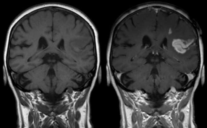 MRI of human brain.