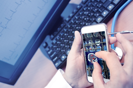 hand enlarging MRI image on smartphone