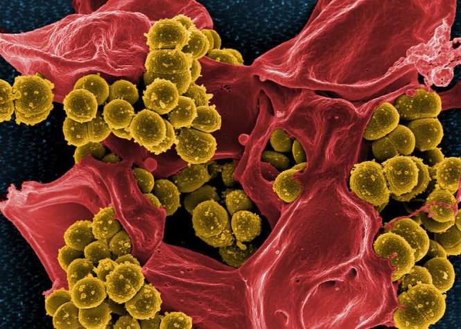 A colored electron microscope image of MRSA.