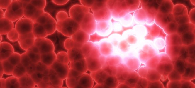 (Illustration of growing cancer tumor.)