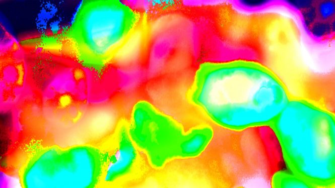 A heat map of thermogenic fat cells [artistic rendering]. (Image courtesy of Life Sciences Institute, multimedia designer Rajani Arora.)