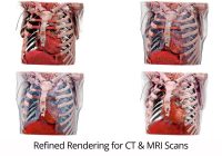 CT and MRI renderings from Table 8 software