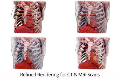 CT and MRI renderings from Table 8 software