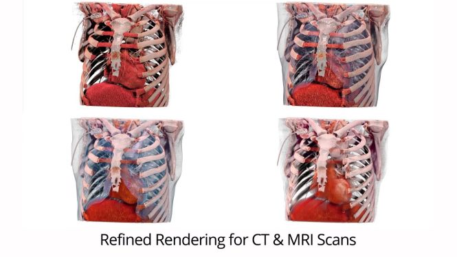 CT and MRI renderings from Table 8 software