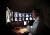 Dr. Todd sits in front of three computer monitors that have x-rays on them of lungs and brains.